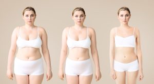 Young,Woman,Before,And,After,Slimming,On,Color,Background.,Stages
