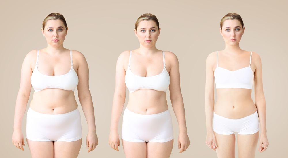 Young,Woman,Before,And,After,Slimming,On,Color,Background.,Stages